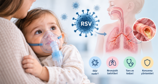 RSV bronşiolit
